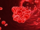 FDA chấp thuận thuốc mới trị bệnh đa hồng cầu